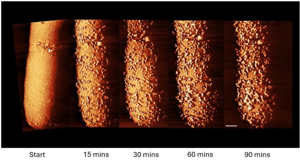 First images captured of an antibiotic annihilating bacteria in real time | De Último Minuto English