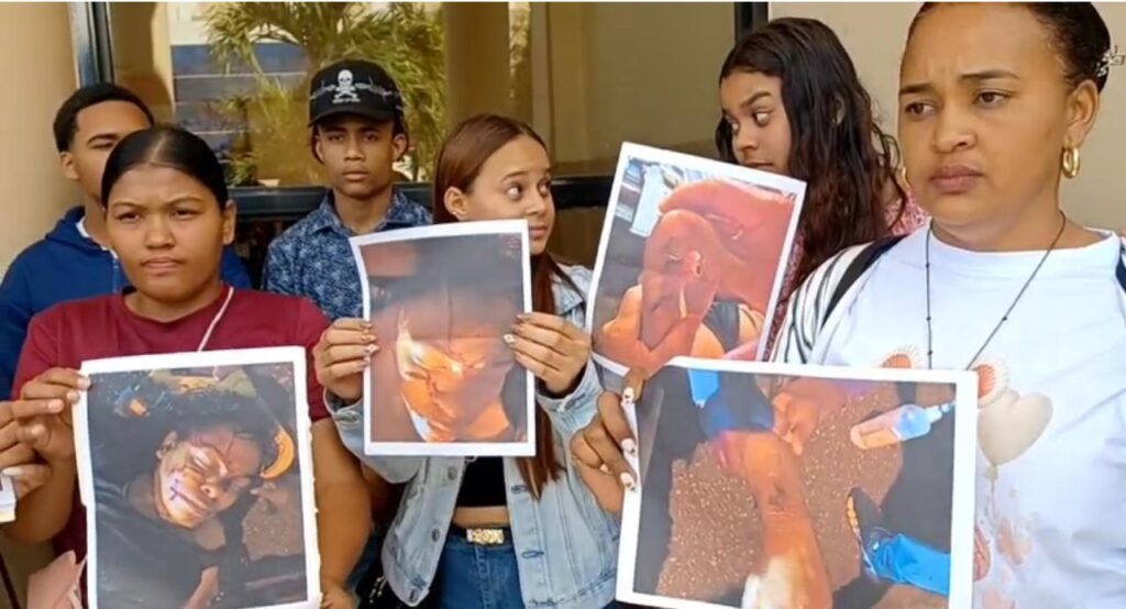 Dictan tres meses de prisión preventiva a joven acusado de apuñalar 17 veces a su pareja en Mao - Noticias de hoy en República Dominicana | De Último Minuto