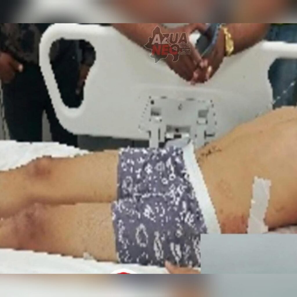 Hieren de bala a joven en tiroteo en Azua; autoridades profundizan investigación - Noticias de hoy en República Dominicana | De Último Minuto